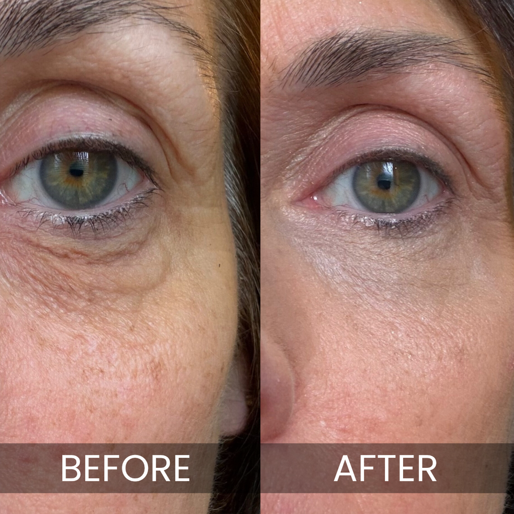 Luxe Korean Under-Eye Balm - Rest optional. Bright eyes, always.