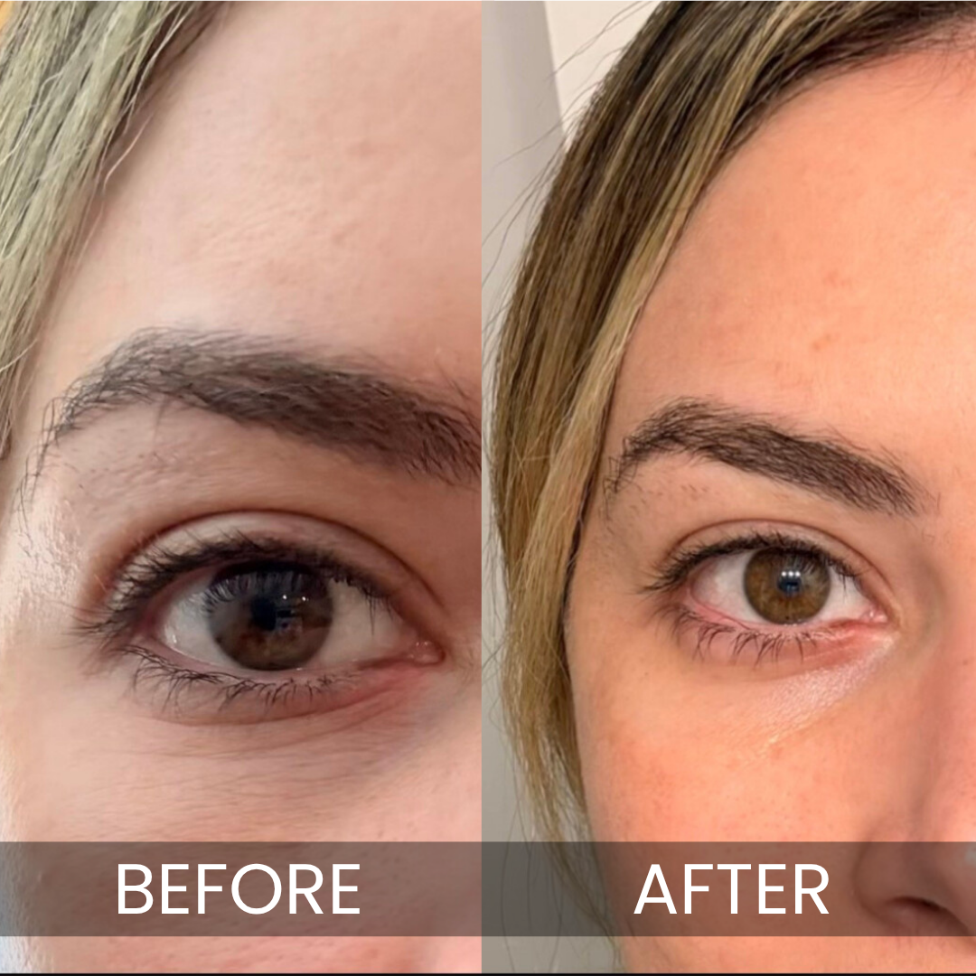 Luxe Korean Under-Eye Balm - Rest optional. Bright eyes, always.